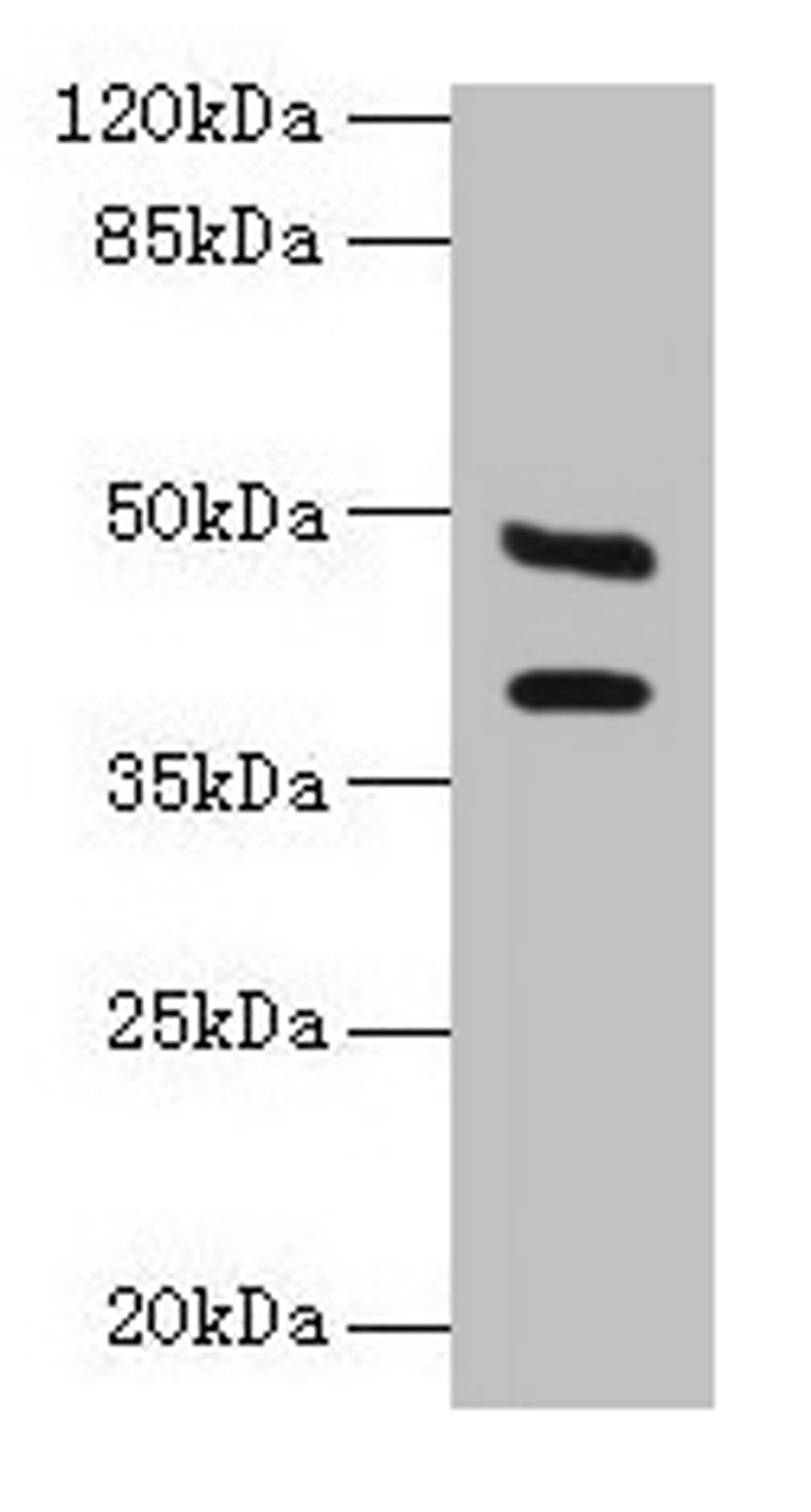 Western blot. All lanes: CA12 antibody at 6µg/ml + Mouse kidney tissue. Secondary. Goat polyclonal to rabbit IgG at 1/10000 dilution. Predicted band size: 40, 39 kDa. Observed band size: 40, 48 kDa