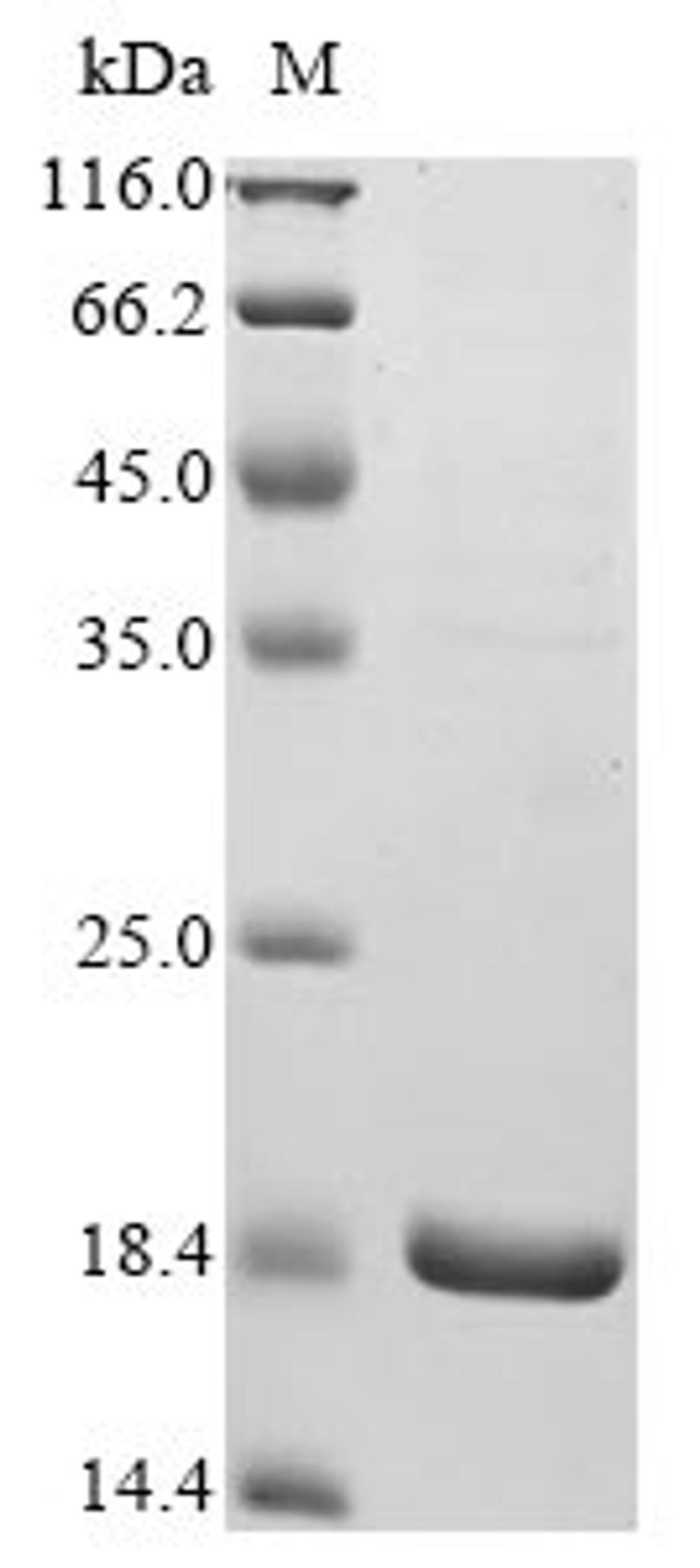 (Tris-Glycine gel) Discontinuous SDS-PAGE (reduced) with 5% enrichment gel and 15% separation gel.