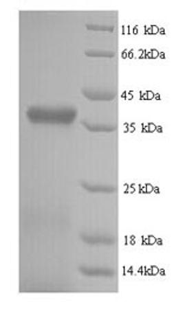 (Tris-Glycine gel) Discontinuous SDS-PAGE (reduced) with 5% enrichment gel and 15% separation gel.