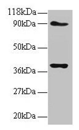 Western blot. All lanes: NDUFS5 antibody at 2µg/ml. Lane 1: EC109 whole cell lysate. Lane 2: 293T whole cell lysate. Secondary. Goat polyclonal to rabbit IgG at 1/15000 dilution. Predicted band size: 13 kDa. Observed band size: 40 kDa
