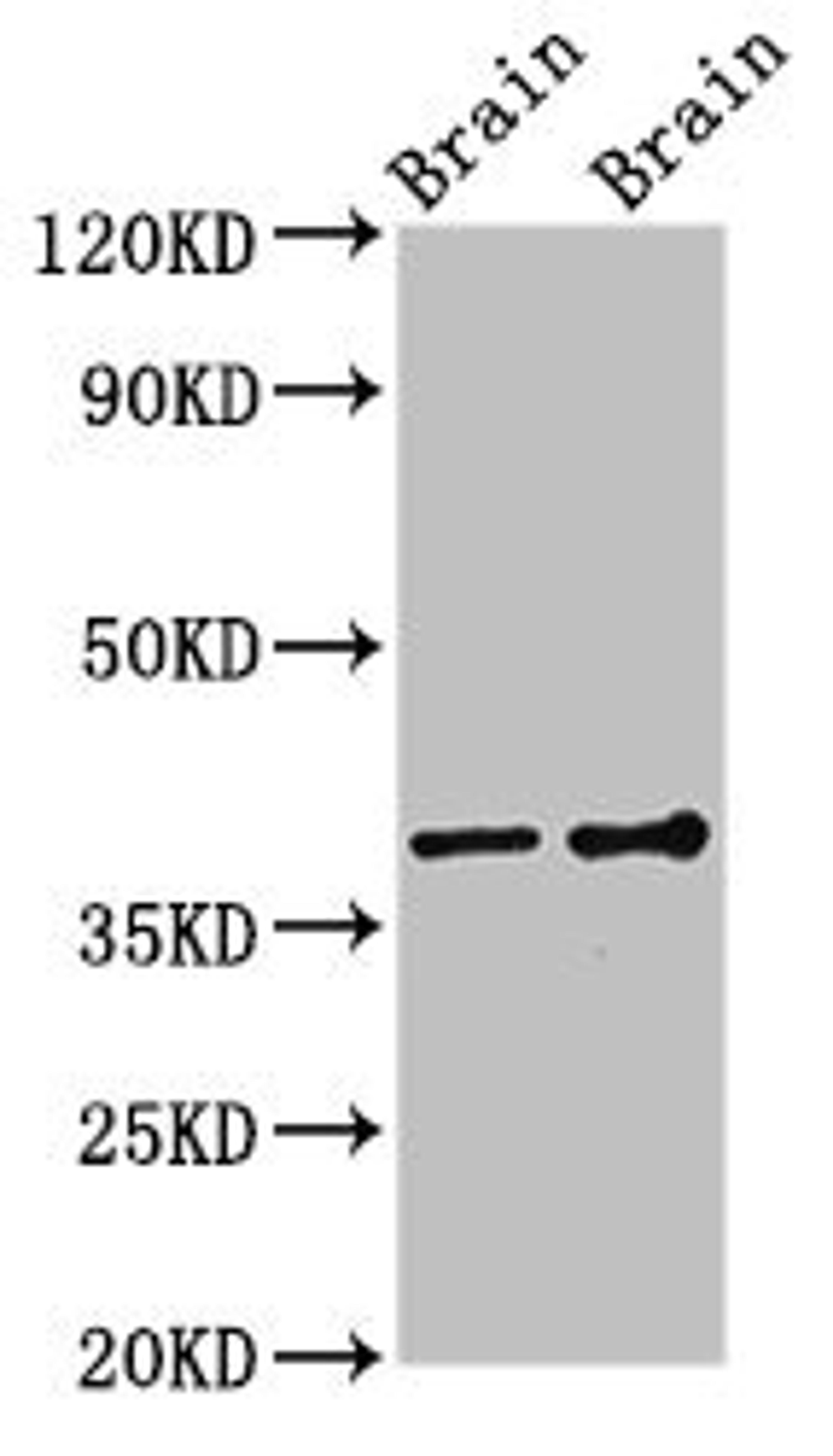 Western Blot. Positive WB detected in: Rat brain tissue, Mouse brain tissue. All lanes: GNB1 antibody at 3ug/ml. Secondary. Goat polyclonal to rabbit IgG at 1/50000 dilution. Predicted band size: 38, 37 kDa. Observed band size: 38 kDa. 