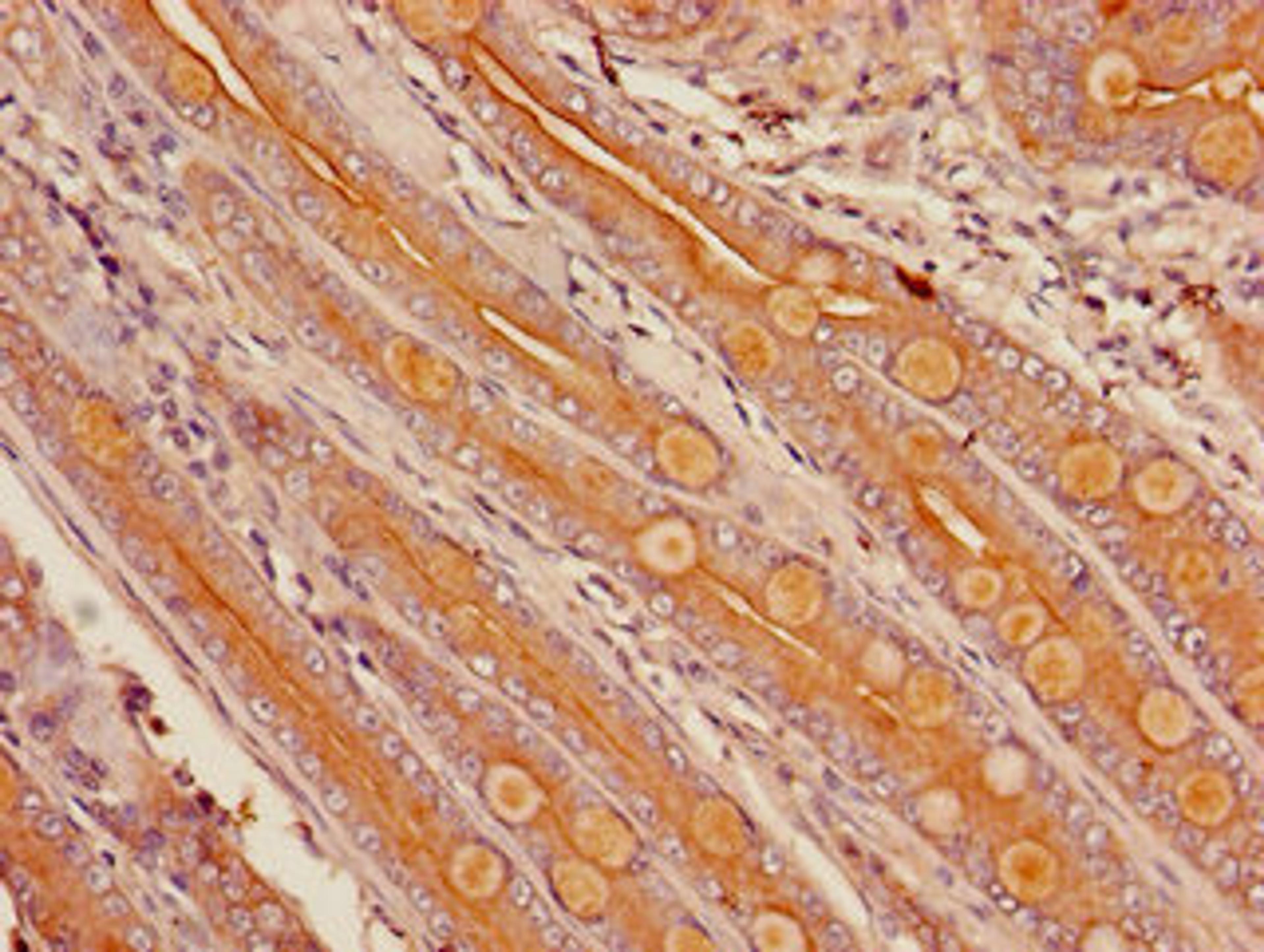 Immunohistochemistry of paraffin-embedded human small intestine tissue using CSB-PA006439LA01HU at dilution of 1:100