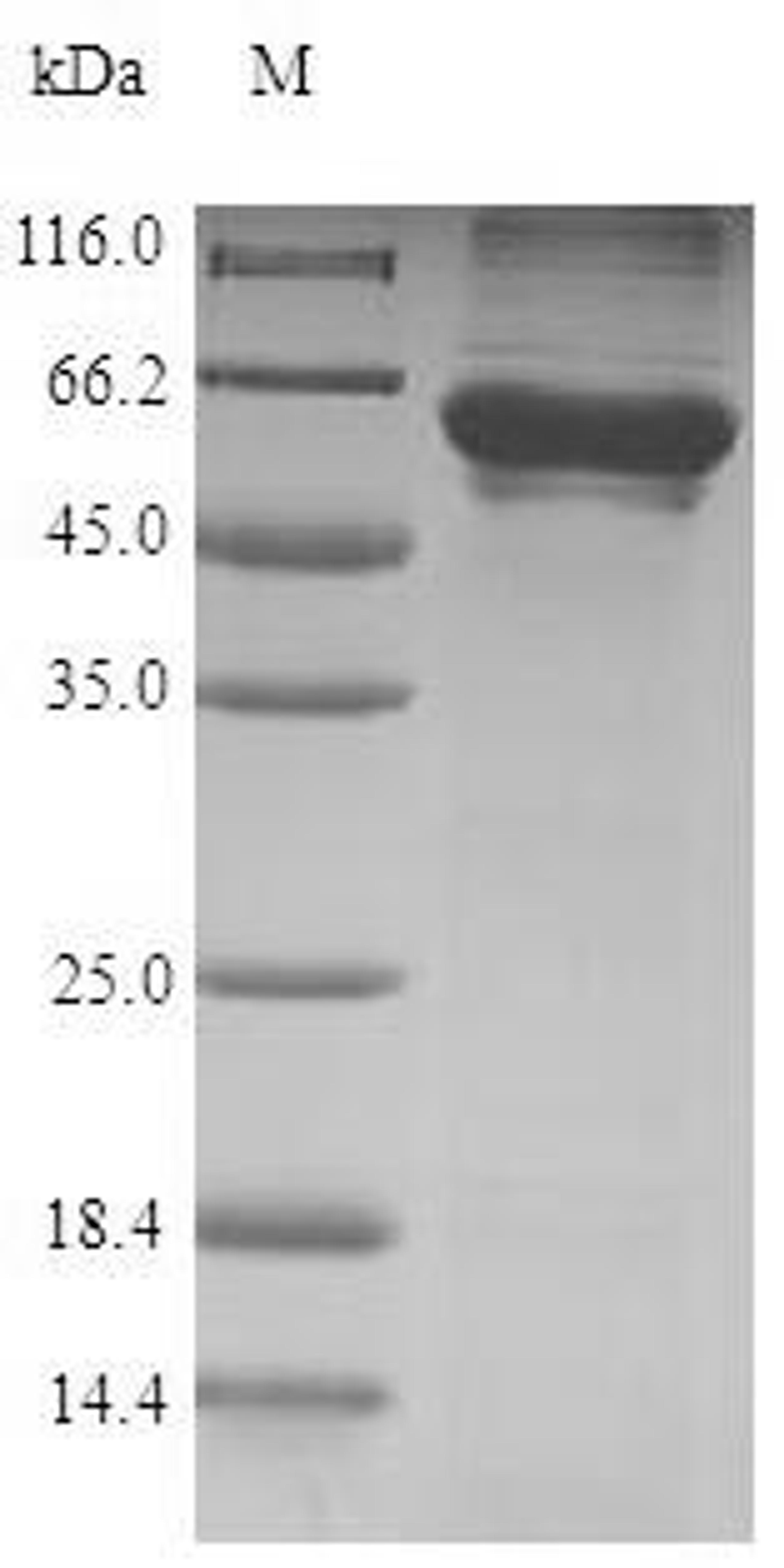 (Tris-Glycine gel) Discontinuous SDS-PAGE (reduced) with 5% enrichment gel and 15% separation gel.