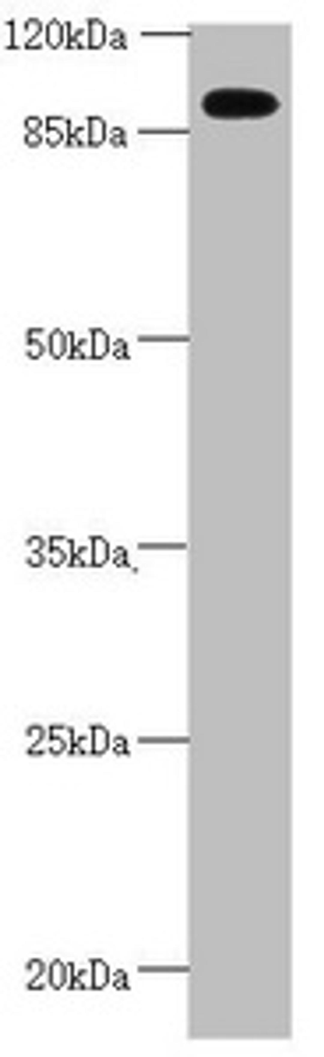 Western blot. All lanes: CEP95 antibody at 2.67 ug/ml + Mouse heart tissue. Secondary. Goat polyclonal to rabbit IgG at 1/10000 dilution. Predicted band size: 96, 77 kDa. Observed band size: 96 kDa. 