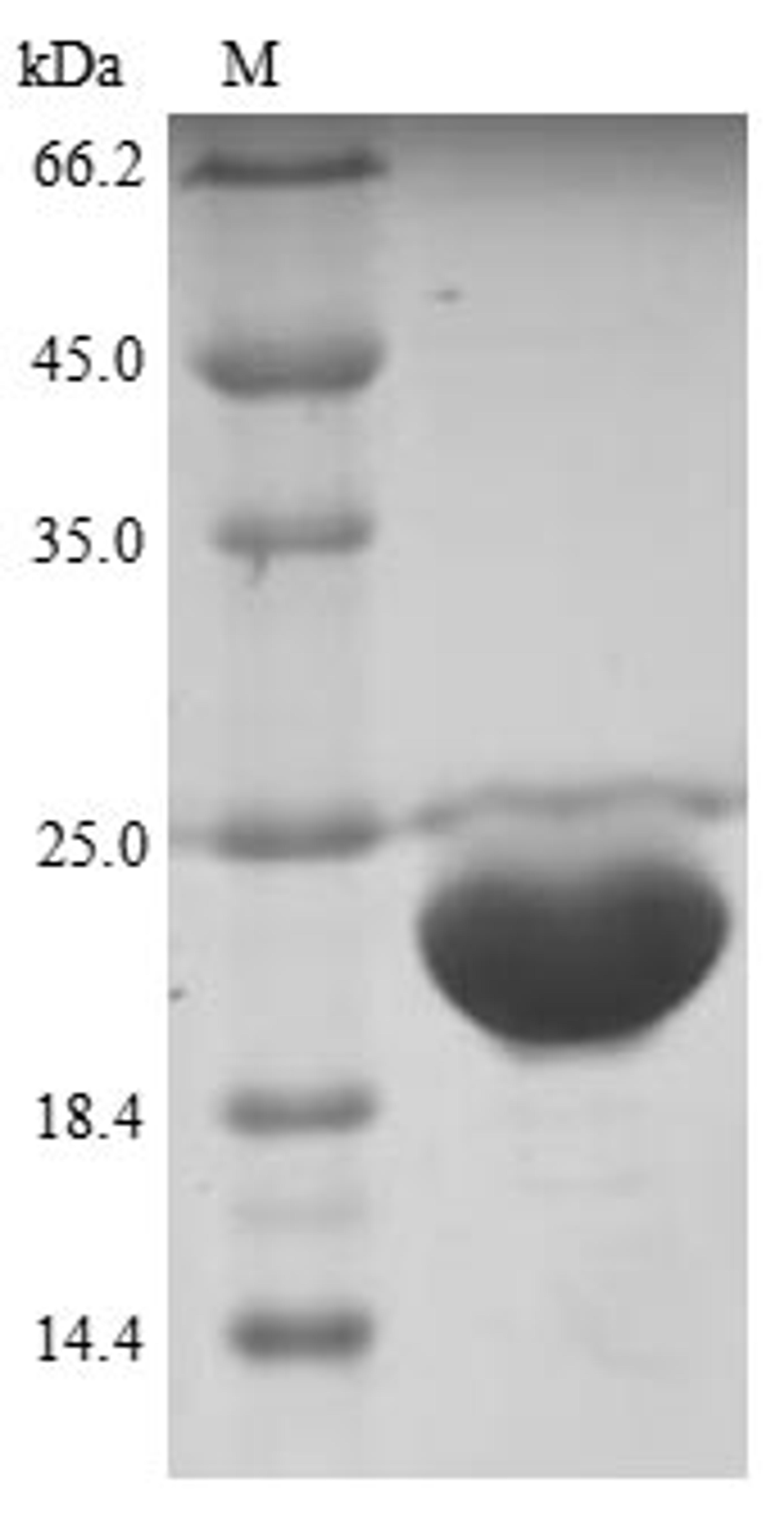 (Tris-Glycine gel) Discontinuous SDS-PAGE (reduced) with 5% enrichment gel and 15% separation gel.