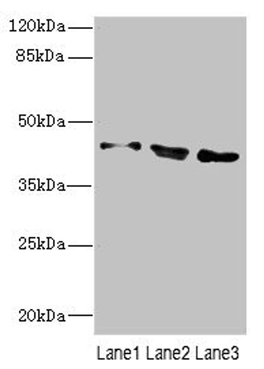 Western blot. All lanes: CAMK1Dantibody at 2.9ug/ml. Lane 1: A549 whole cell lysate. Lane 2: 293T whole cell lysate. Lane 3: Jurkat whole cell lysate. Secondary. Goat polyclonal to rabbit IgG at 1/10000 dilution. Predicted band size: 43, 41 kDa. Observed band size: 43 kDa. 