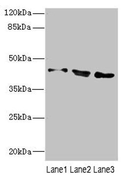 Western blot. All lanes: CAMK1Dantibody at 2.9ug/ml. Lane 1: A549 whole cell lysate. Lane 2: 293T whole cell lysate. Lane 3: Jurkat whole cell lysate. Secondary. Goat polyclonal to rabbit IgG at 1/10000 dilution. Predicted band size: 43, 41 kDa. Observed band size: 43 kDa. 