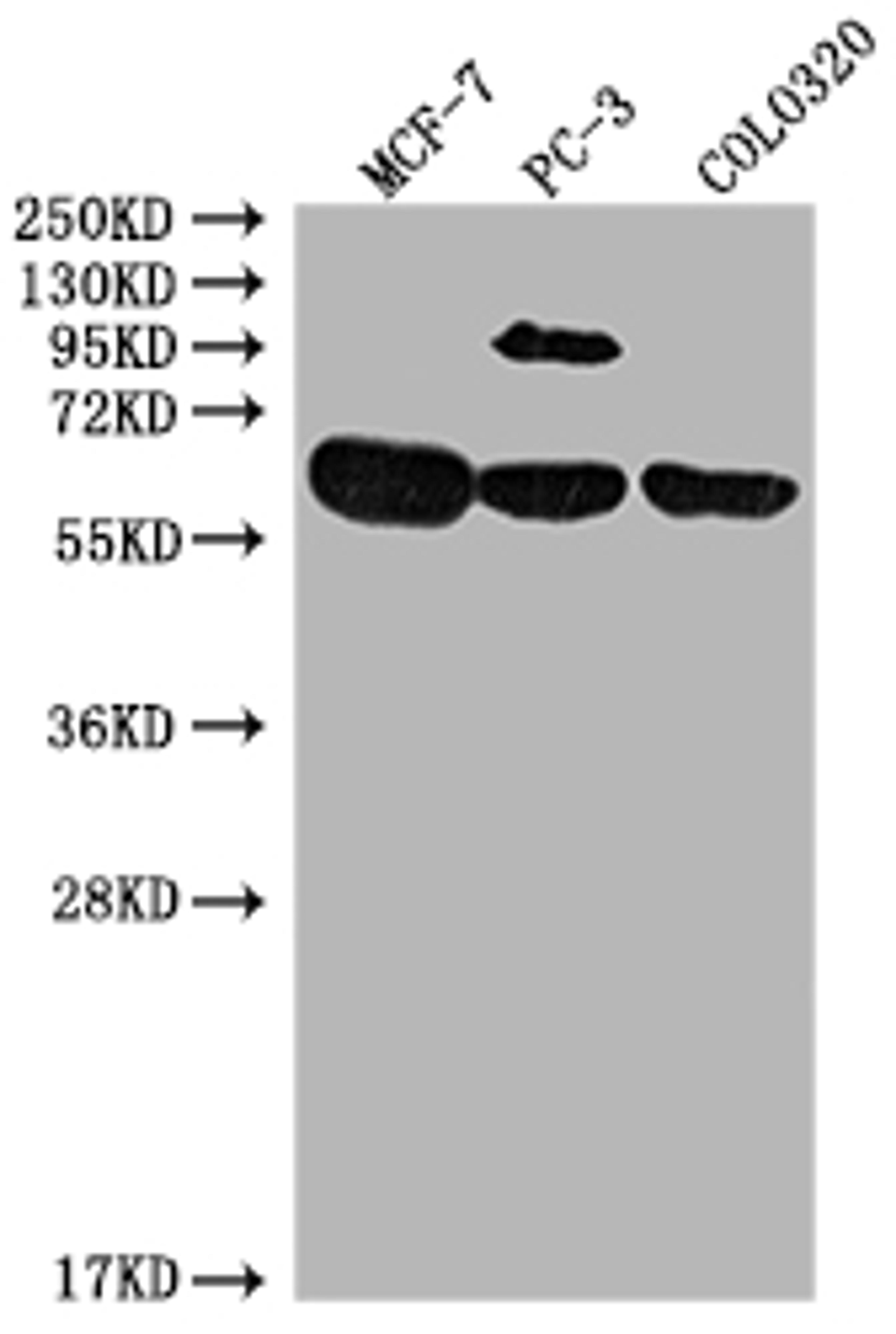 Western Blot. Positive WB detected in: MCF-7 whole cell lysate, PC-3 whole cell lysate, COLO320 whole cell lysate. All lanes: SRC antibody at 1:2000. Secondary. Goat polyclonal to rabbit IgG at 1/50000 dilution. Predicted band size: 60, 61 kDa. Observed band size: 60 kDa. 