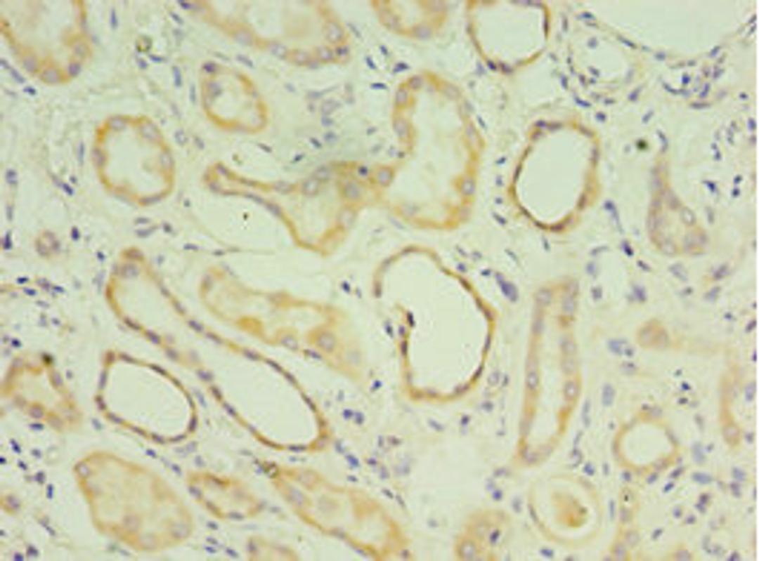 Immunohistochemistry of paraffin-embedded human kidney tissue using CSB-PA013522ESR1HU at dilution of 1:100