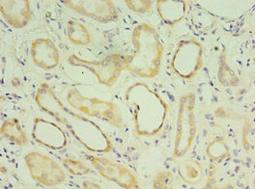 Immunohistochemistry of paraffin-embedded human kidney tissue using CSB-PA013522ESR1HU at dilution of 1:100
