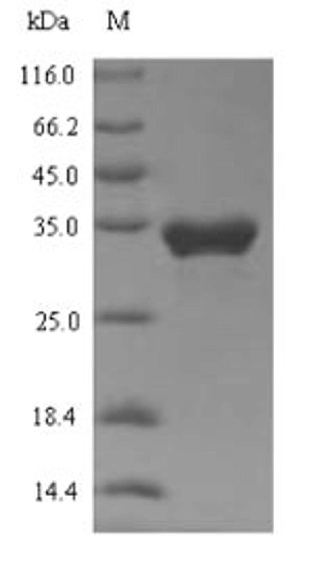(Tris-Glycine gel) Discontinuous SDS-PAGE (reduced) with 5% enrichment gel and 15% separation gel.