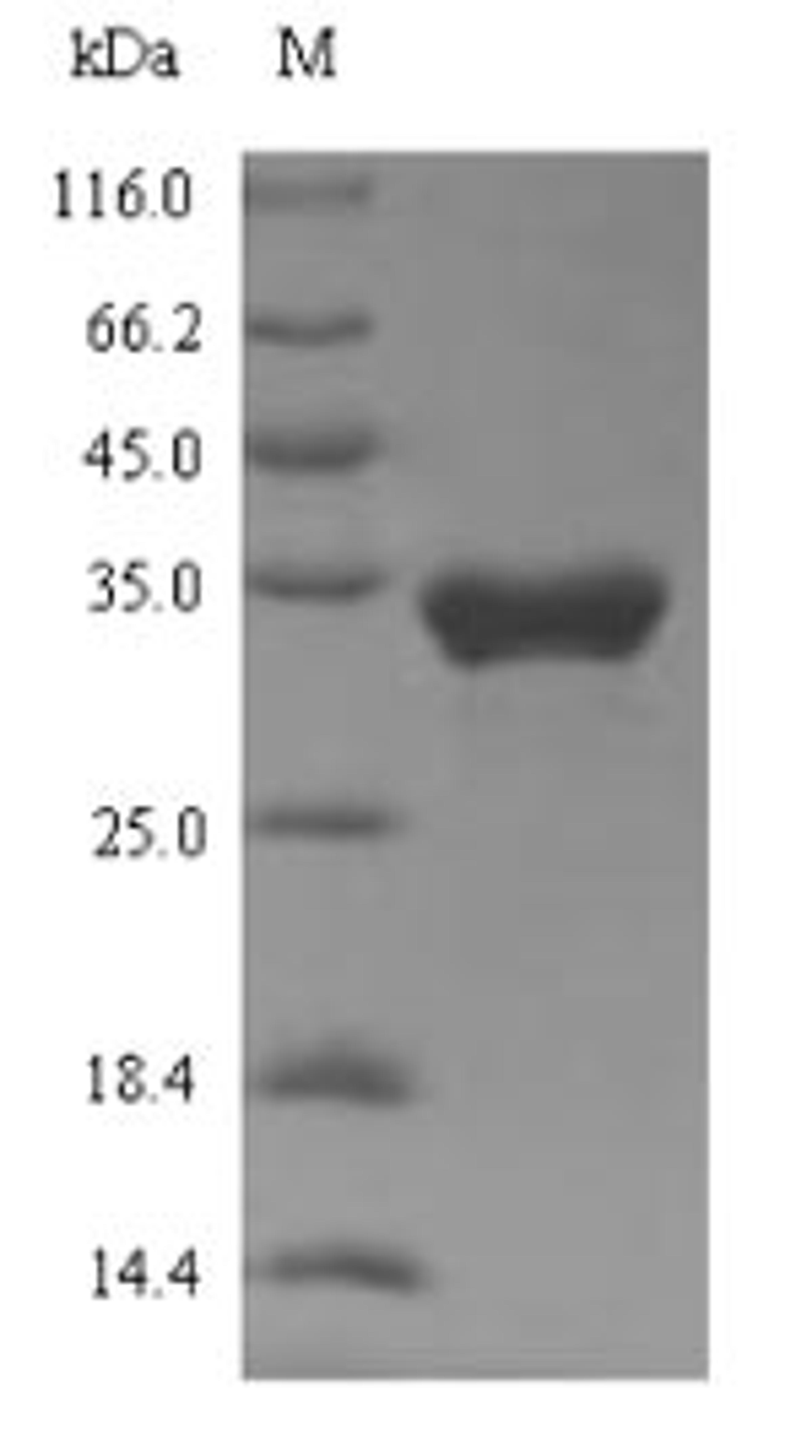 (Tris-Glycine gel) Discontinuous SDS-PAGE (reduced) with 5% enrichment gel and 15% separation gel.