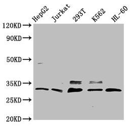 Western Blot. Positive WB detected in: HepG2 whole cell lysate, Jurkat whole cell lysate, 293T whole cell lysate, K562 whole cell lysate, HL-60 whole cell lysate. All lanes: GEMIN2 antibody at 3.7µg/ml. Secondary. Goat polyclonal to rabbit IgG at 1/50000 dilution. Predicted band size: 32, 30, 29, 5 kDa. Observed band size: 32 kDa