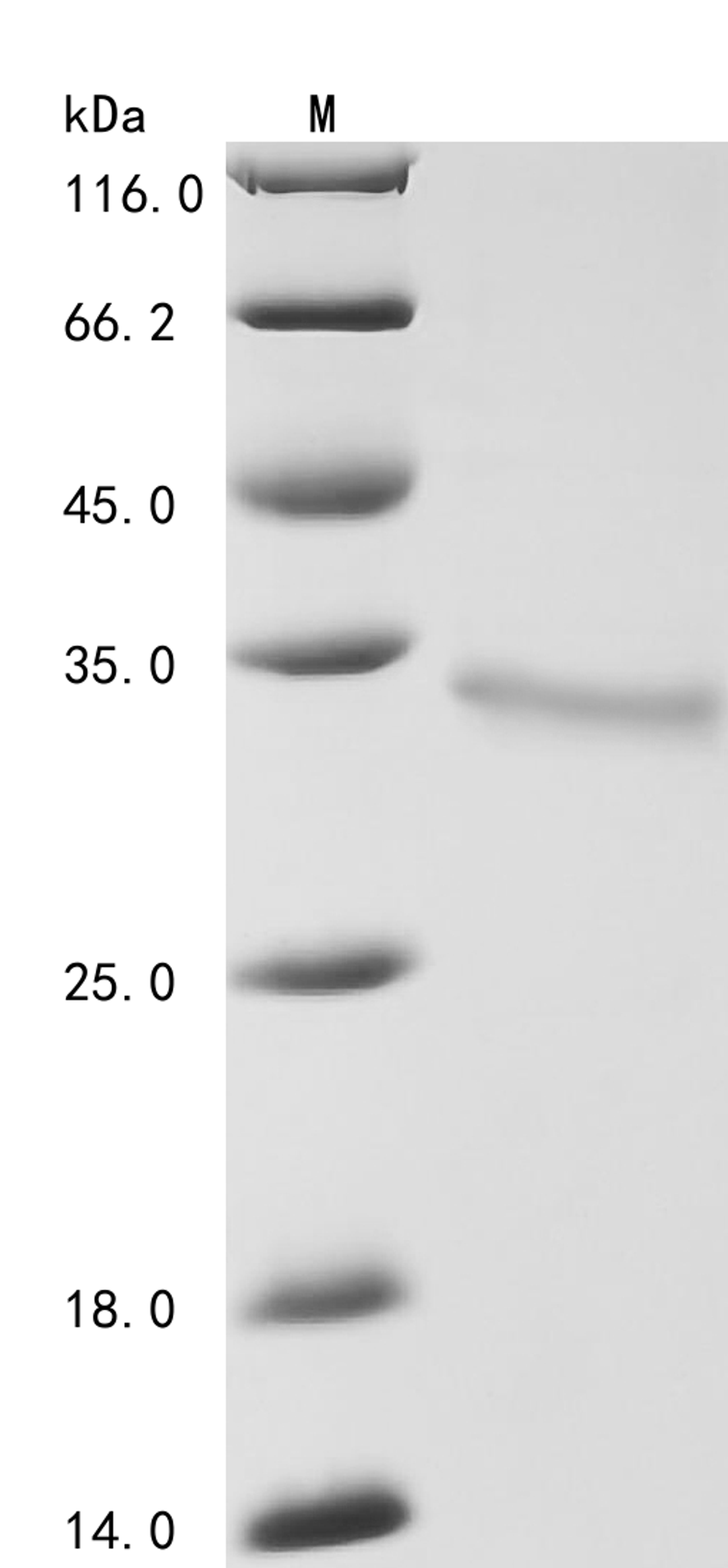 (Tris-Glycine gel) Discontinuous SDS-PAGE (reduced) with 5% enrichment gel and 15% separation gel.