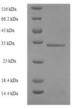 (Tris-Glycine gel) Discontinuous SDS-PAGE (reduced) with 5% enrichment gel and 15% separation gel.
