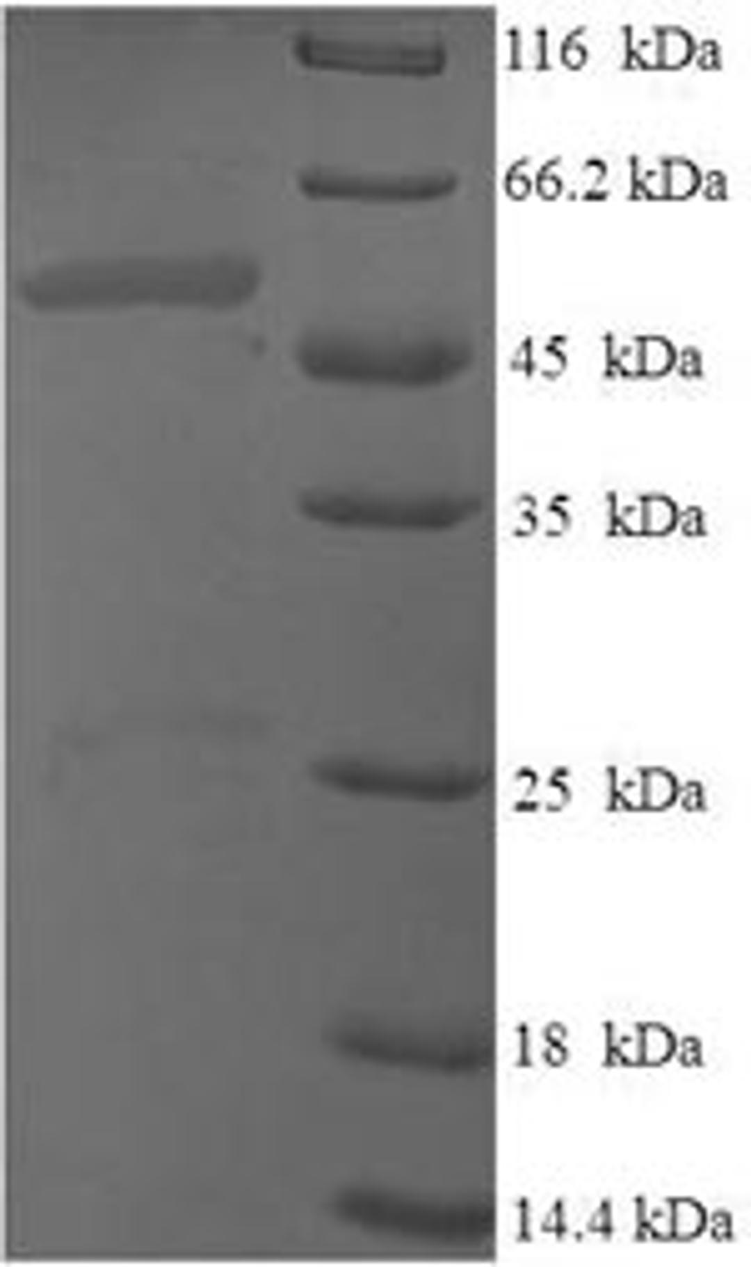 (Tris-Glycine gel) Discontinuous SDS-PAGE (reduced) with 5% enrichment gel and 15% separation gel.