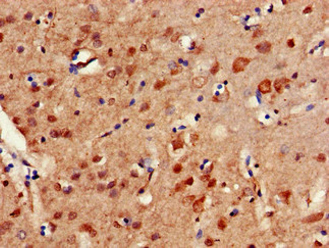 Immunohistochemistry of paraffin-embedded human brain tissue using CSB-PA849795HA01HU at dilution of 1:100