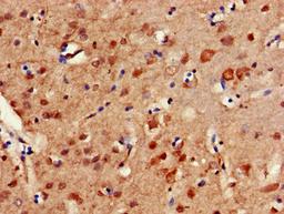 Immunohistochemistry of paraffin-embedded human brain tissue using CSB-PA849795HA01HU at dilution of 1:100