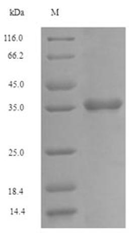 (Tris-Glycine gel) Discontinuous SDS-PAGE (reduced) with 5% enrichment gel and 15% separation gel.