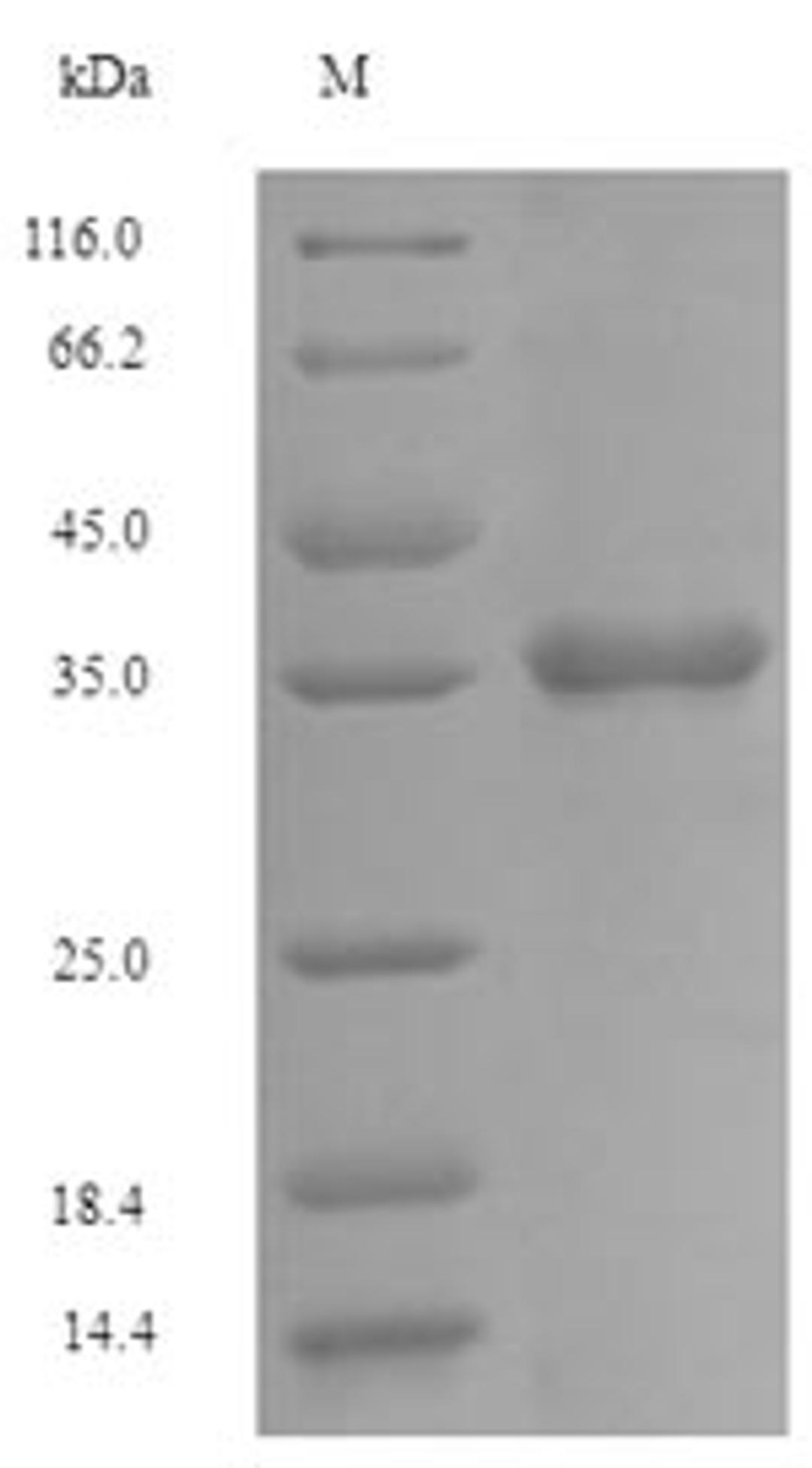(Tris-Glycine gel) Discontinuous SDS-PAGE (reduced) with 5% enrichment gel and 15% separation gel.