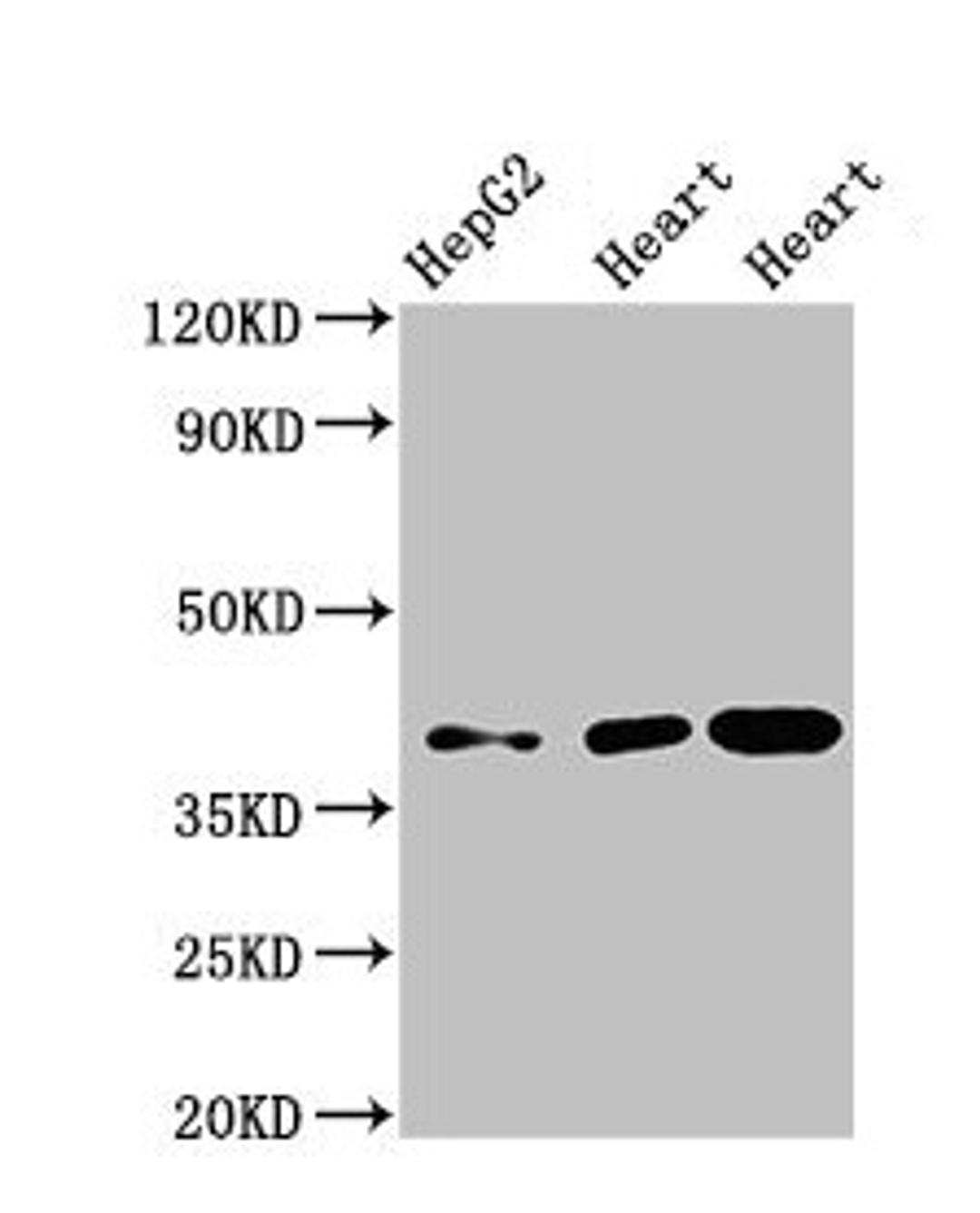 Western Blot. Positive WB detected in: HepG2 whole cell lysate, Rat heart tissue, Mouse heart tissue. All lanes: WISP3 antibody at 3.5µg/ml. Secondary. Goat polyclonal to rabbit IgG at 1/50000 dilution. Predicted band size: 40, 42 kDa. Observed band size: 40 kDa