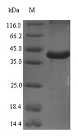 (Tris-Glycine gel) Discontinuous SDS-PAGE (reduced) with 5% enrichment gel and 15% separation gel.