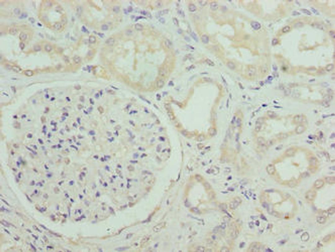 Immunohistochemistry of paraffin-embedded human kidney tissue using CSB-PA835675LA01HU at dilution of 1:100