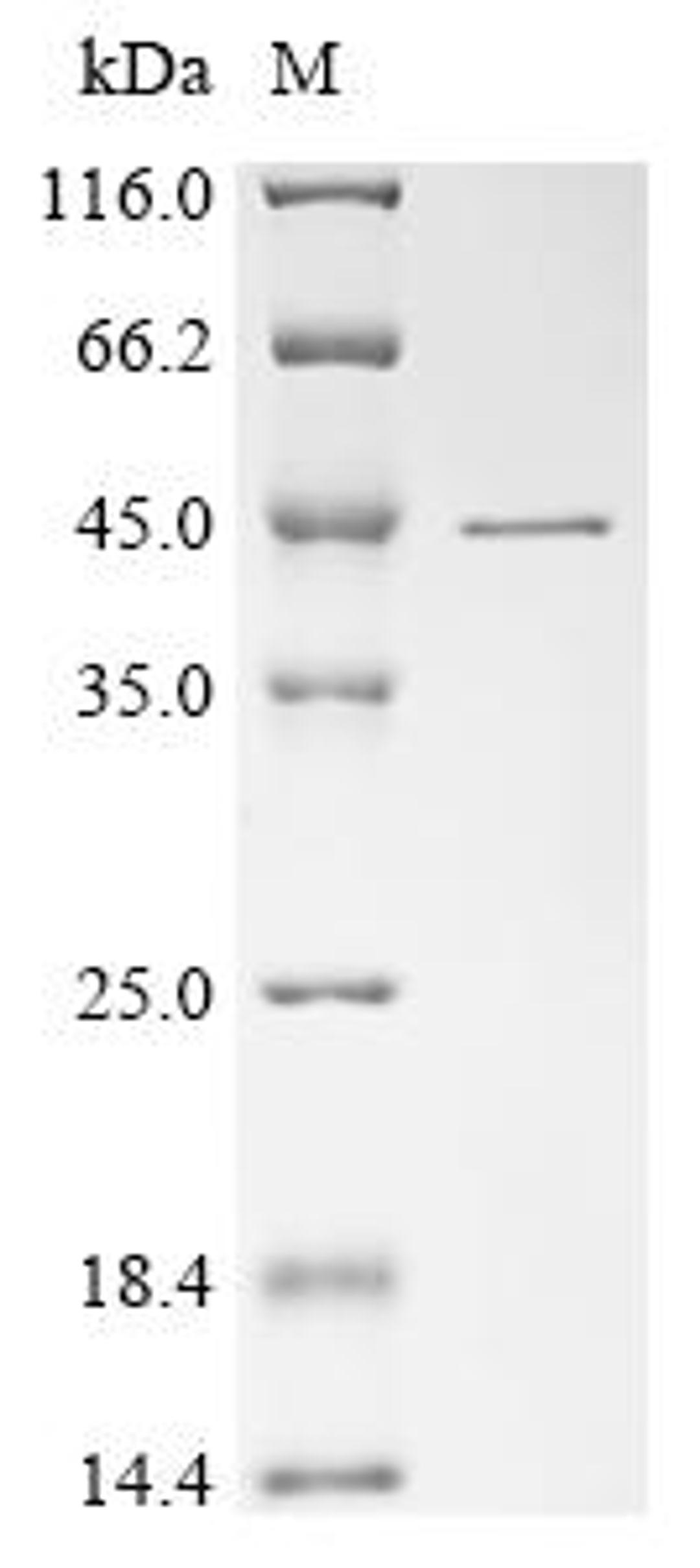 (Tris-Glycine gel) Discontinuous SDS-PAGE (reduced) with 5% enrichment gel and 15% separation gel.