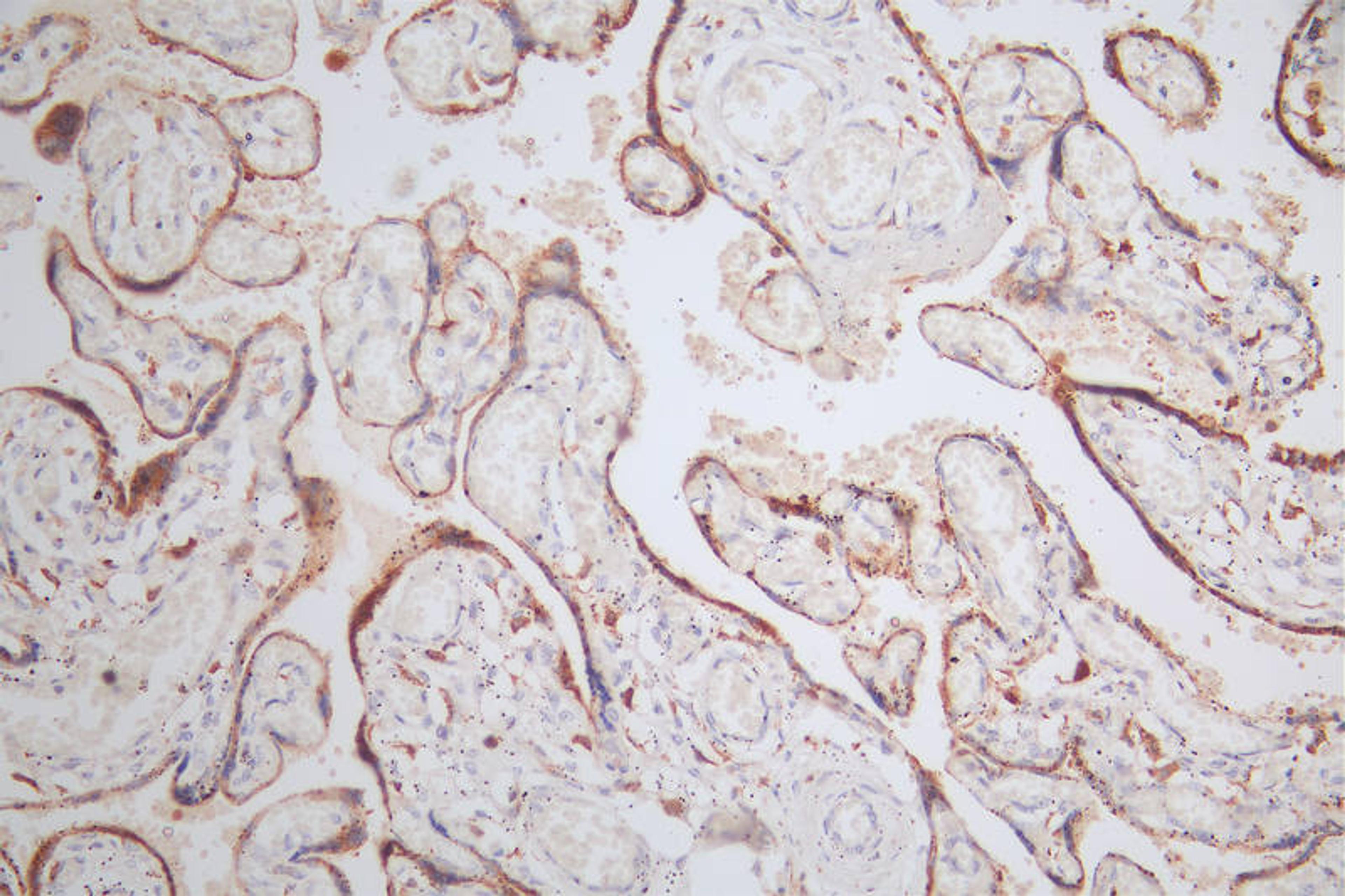 IHC image of CSB-RA579492A0HU diluted at 1:80 and staining in paraffin-embedded human placenta tissue performed on a Leica BondTM system. After dewaxing and hydration, antigen retrieval was mediated by high pressure in a citrate buffer (pH 6.0). Section was blocked with 10% normal goat serum 30min at RT. Then primary antibody (1% BSA) was incubated at 4°C overnight. The primary is detected by a Goat anti-rabbit polymer IgG labeled by HRP and visualized using 0.48% DAB.