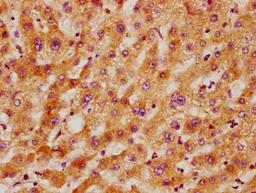 IHC image of CSB-PA5619A0Rb diluted at 1:300 and staining in paraffin-embedded human liver tissue performed on a Leica BondTM system. After dewaxing and hydration, antigen retrieval was mediated by high pressure in a citrate buffer (pH 6.0). Section was blocked with 10% normal goat serum 30min at RT. Then primary antibody (1% BSA) was incubated at 4&deg;C overnight. The primary is detected by a biotinylated secondary antibody and visualized using an HRP conjugated SP system.
