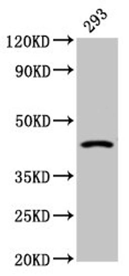 Western Blot. Positive WB detected in: 293 whole cell lysate. All lanes: HSD11B2 antibody at 2.4µg/ml. Secondary. Goat polyclonal to rabbit IgG at 1/50000 dilution. Predicted band size: 45 kDa. Observed band size: 45 kDa
