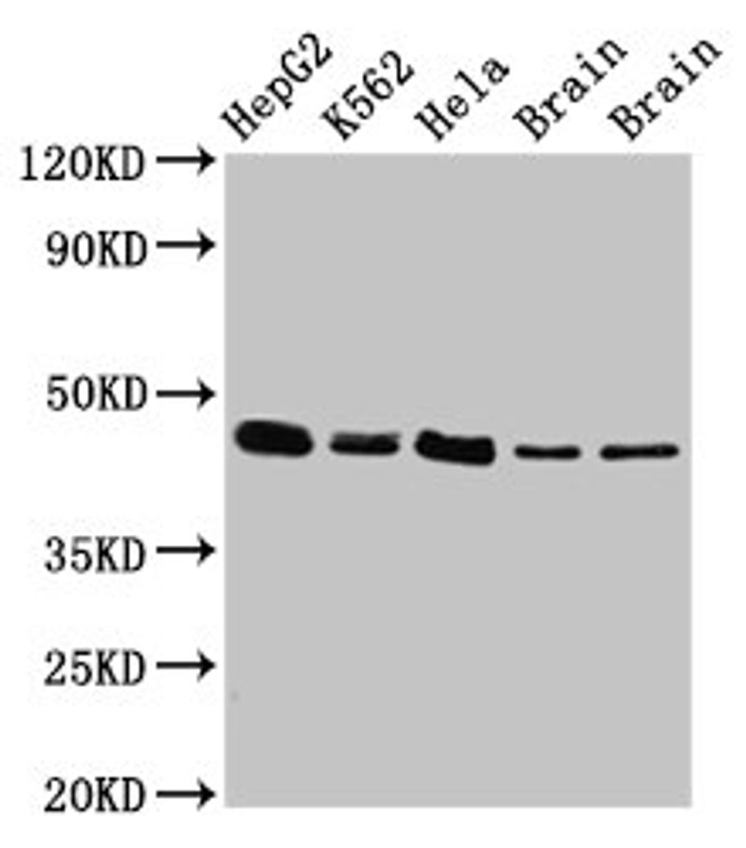 Western Blot. Positive WB detected in: HepG2 whole cell lysate, K562 whole cell lysate, Hela whole cell lysate, Rat brain tissue, Mouse brain tissue. All lanes: FLOT1 antibody at 3µg/ml. Secondary. Goat polyclonal to rabbit IgG at 1/50000 dilution. Predicted band size: 48, 43 kDa. Observed band size: 48 kDa