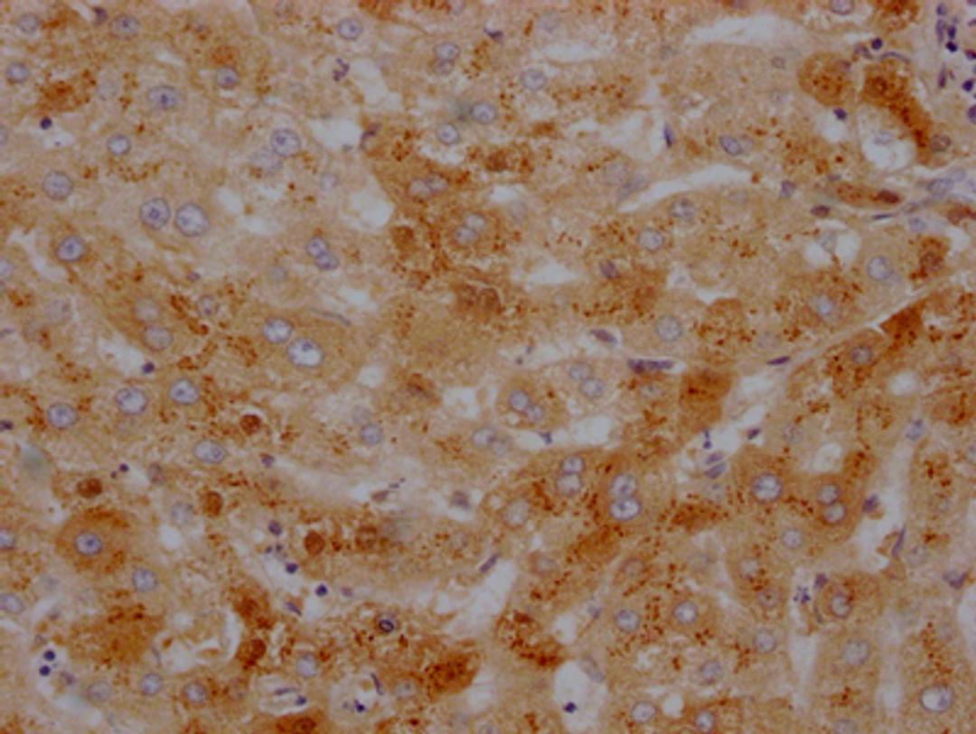 IHC image of CSB-RA437590A0HU diluted at 1:100 and staining in paraffin-embedded human liver tissue performed on a Leica BondTM system. After dewaxing and hydration, antigen retrieval was mediated by high pressure in a citrate buffer (pH 6.0). Section was blocked with 10% normal goat serum 30min at RT. Then primary antibody (1% BSA) was incubated at 4℃ overnight. The primary is detected by a Goat anti-rabbit IgG polymer labeled by HRP and visualized using 0.05% DAB.