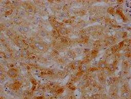 IHC image of CSB-RA437590A0HU diluted at 1:100 and staining in paraffin-embedded human liver tissue performed on a Leica BondTM system. After dewaxing and hydration, antigen retrieval was mediated by high pressure in a citrate buffer (pH 6.0). Section was blocked with 10% normal goat serum 30min at RT. Then primary antibody (1% BSA) was incubated at 4℃ overnight. The primary is detected by a Goat anti-rabbit IgG polymer labeled by HRP and visualized using 0.05% DAB.