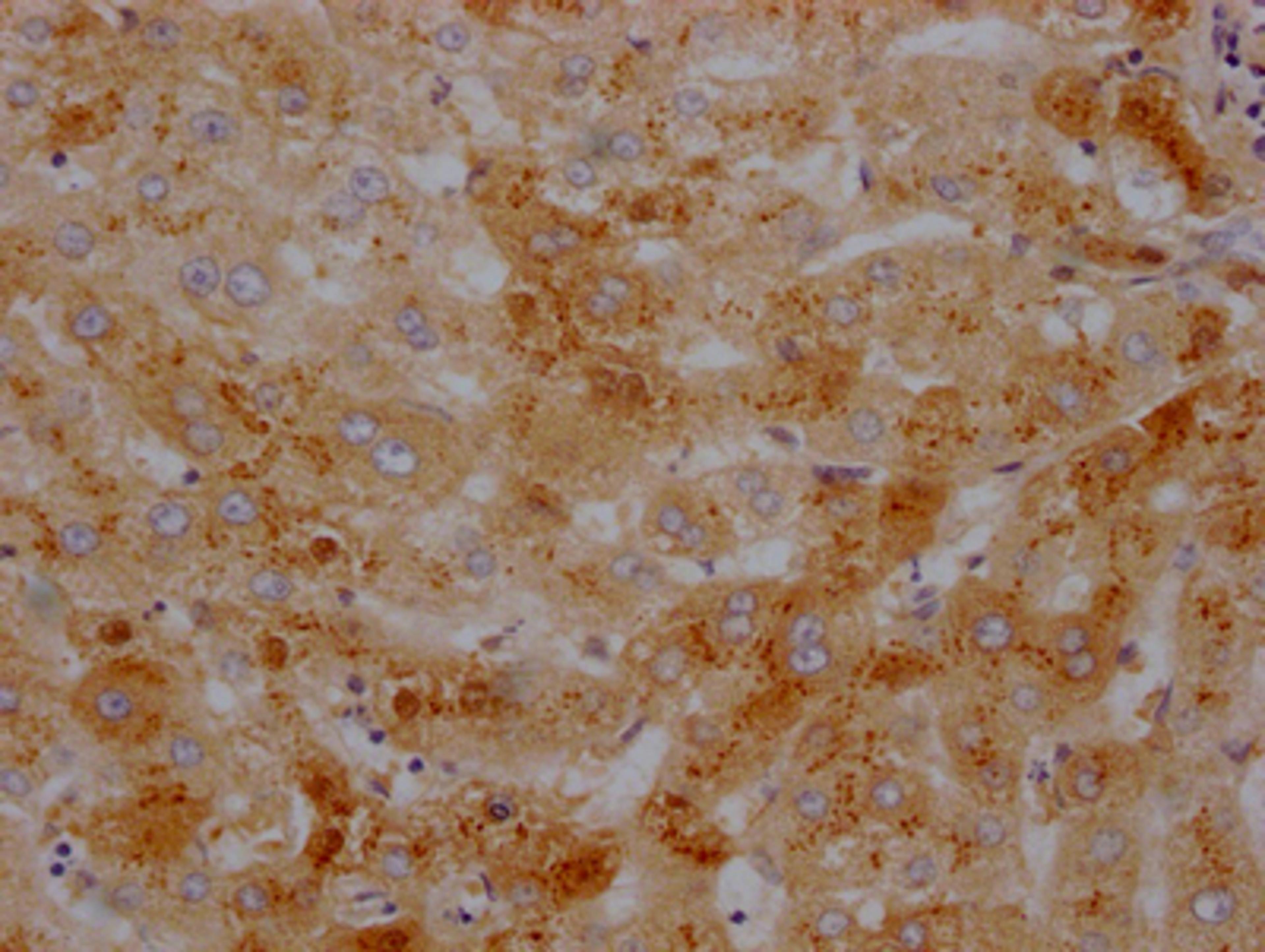 IHC image of CSB-RA437590A0HU diluted at 1:100 and staining in paraffin-embedded human liver tissue performed on a Leica BondTM system. After dewaxing and hydration, antigen retrieval was mediated by high pressure in a citrate buffer (pH 6.0). Section was blocked with 10% normal goat serum 30min at RT. Then primary antibody (1% BSA) was incubated at 4℃ overnight. The primary is detected by a Goat anti-rabbit IgG polymer labeled by HRP and visualized using 0.05% DAB.