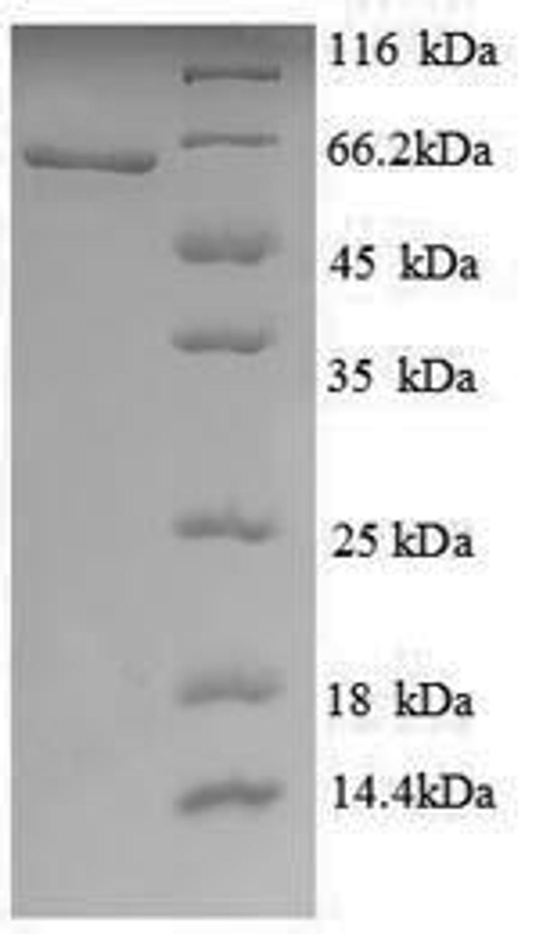 (Tris-Glycine gel) Discontinuous SDS-PAGE (reduced) with 5% enrichment gel and 15% separation gel.