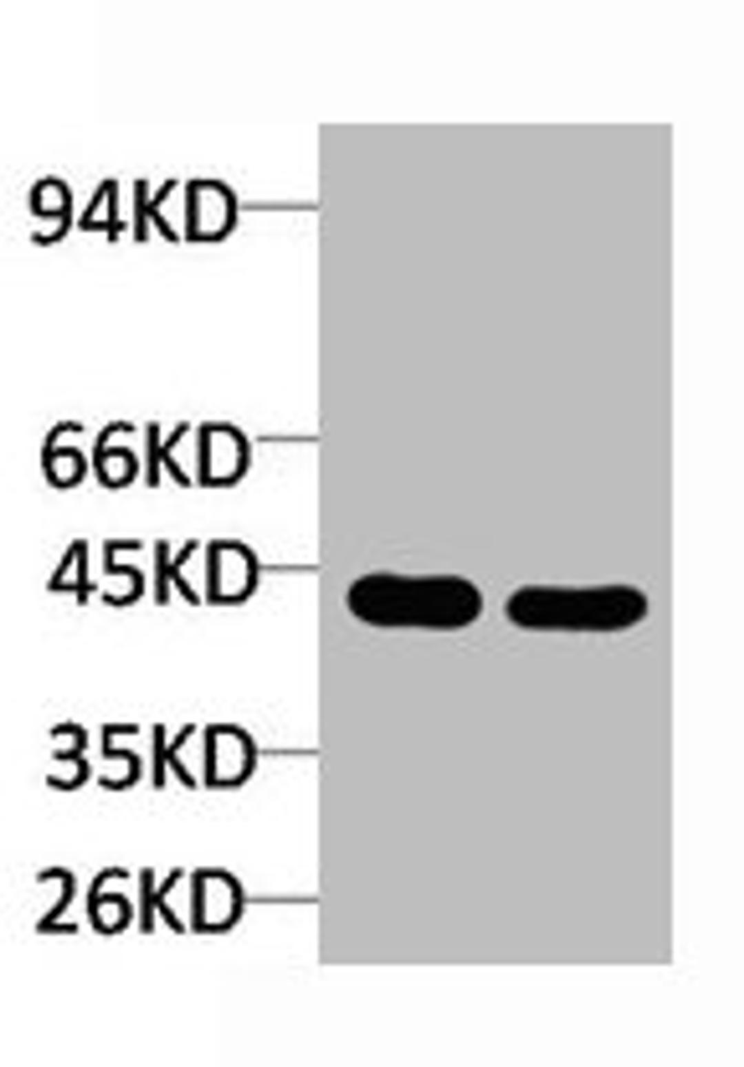 Western blot analysis of 1) Rat LiverTissue, 2)Jurkat with Ghrelin Receptor Rabbit pAb diluted at 1:2,000.