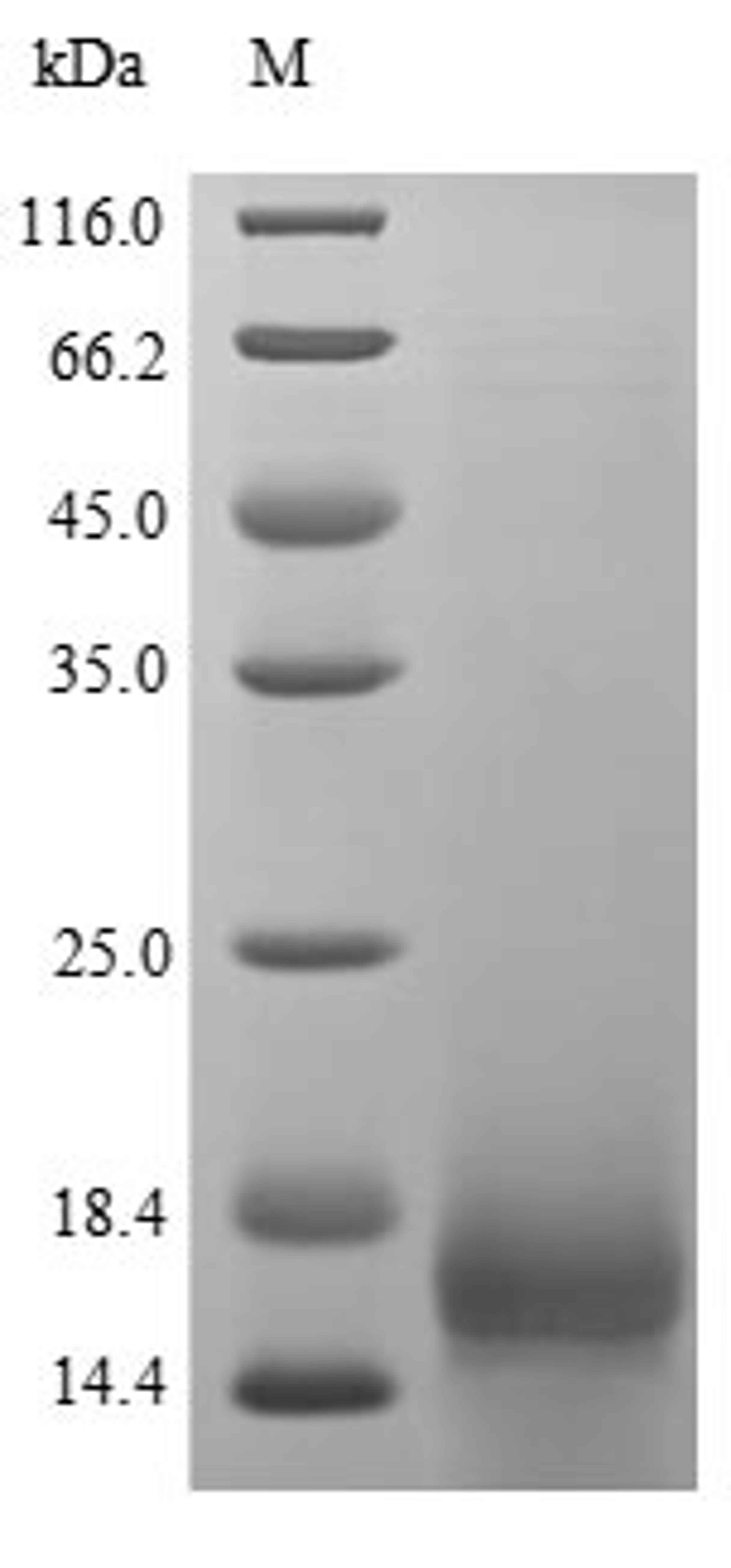 (Tris-Glycine gel) Discontinuous SDS-PAGE (reduced) with 5% enrichment gel and 15% separation gel.