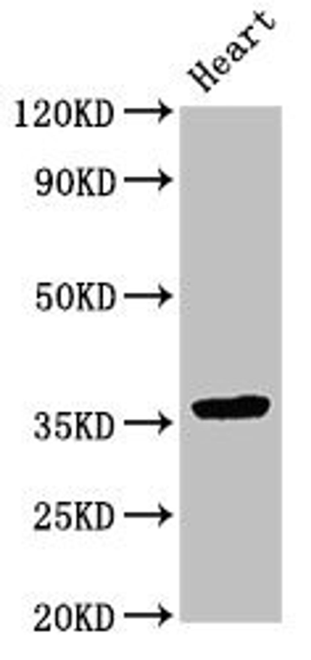 Western Blot. Positive WB detected in: Rat heart tissue. All lanes: NMI antibody at 3.5ug/ml. Secondary. Goat polyclonal to rabbit IgG at 1/50000 dilution. Predicted band size: 36 kDa. Observed band size: 36 kDa. 