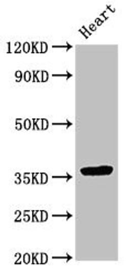 Western Blot. Positive WB detected in: Rat heart tissue. All lanes: NMI antibody at 3.5ug/ml. Secondary. Goat polyclonal to rabbit IgG at 1/50000 dilution. Predicted band size: 36 kDa. Observed band size: 36 kDa. 