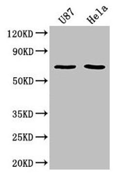 Western Blot. Positive WB detected in: U87 whole cell lysate, Hela whole cell lysate. All lanes: SUSD5 antibody at 1:2000. Secondary. Goat polyclonal to rabbit IgG at 1/50000 dilution. Predicted band size: 69 kDa. Observed band size: 69 kDa. 