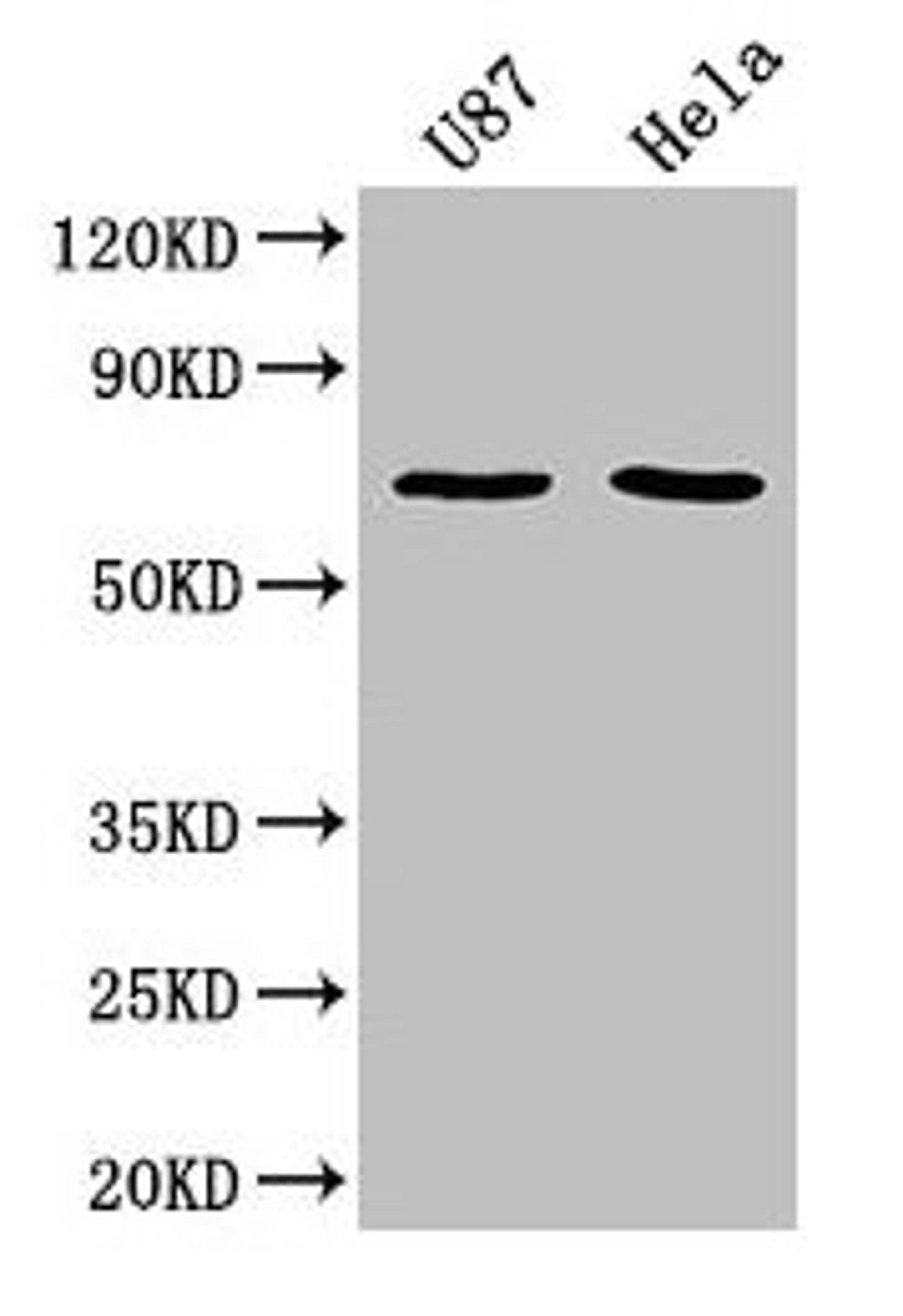 Western Blot. Positive WB detected in: U87 whole cell lysate, Hela whole cell lysate. All lanes: SUSD5 antibody at 1:2000. Secondary. Goat polyclonal to rabbit IgG at 1/50000 dilution. Predicted band size: 69 kDa. Observed band size: 69 kDa. 