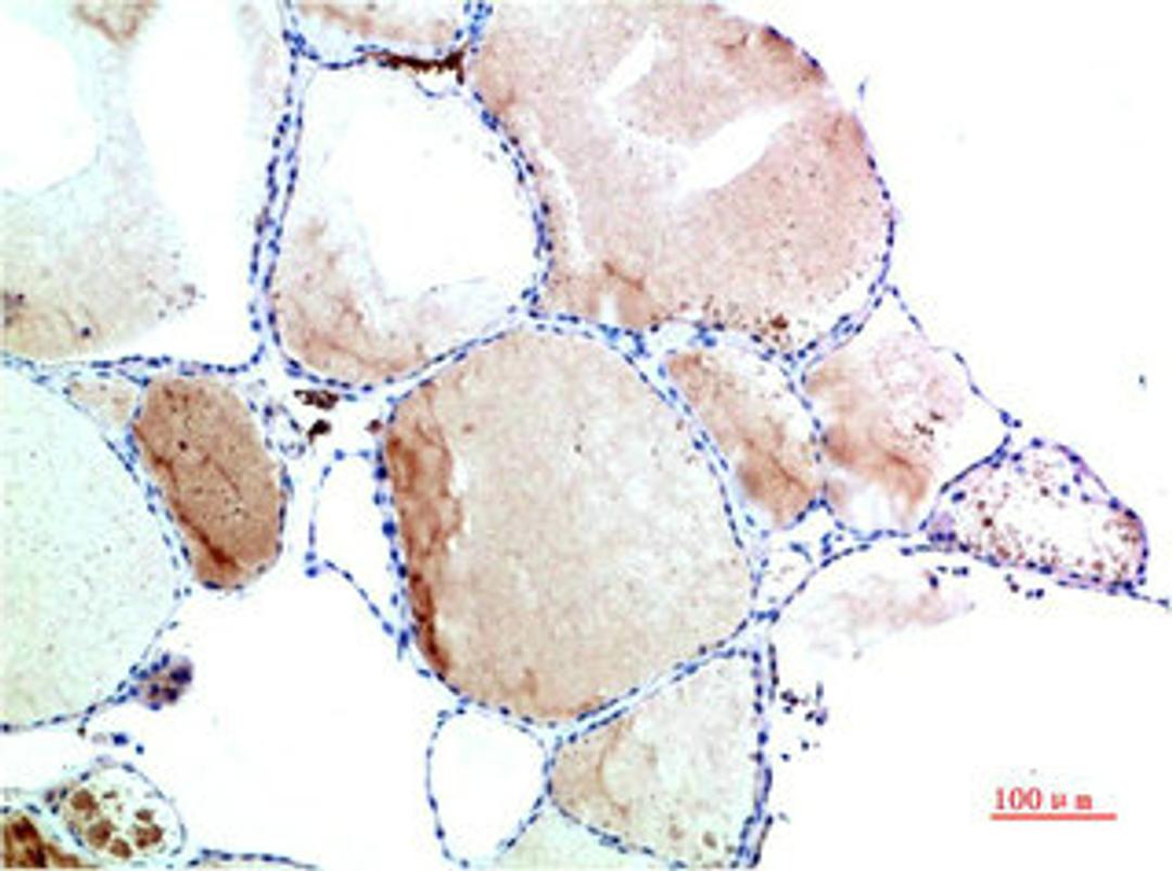 Immunohistochemical analysis of paraffin-embedded Human Thyroid Tissue using TTR Mouse mAb diluted at 1:200.