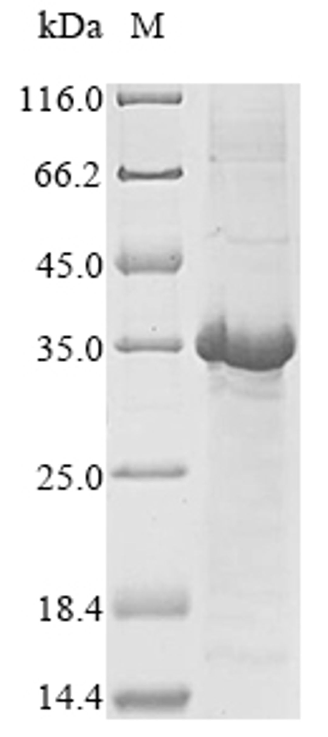(Tris-Glycine gel) Discontinuous SDS-PAGE (reduced) with 5% enrichment gel and 15% separation gel.