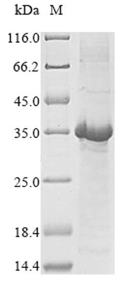 (Tris-Glycine gel) Discontinuous SDS-PAGE (reduced) with 5% enrichment gel and 15% separation gel.