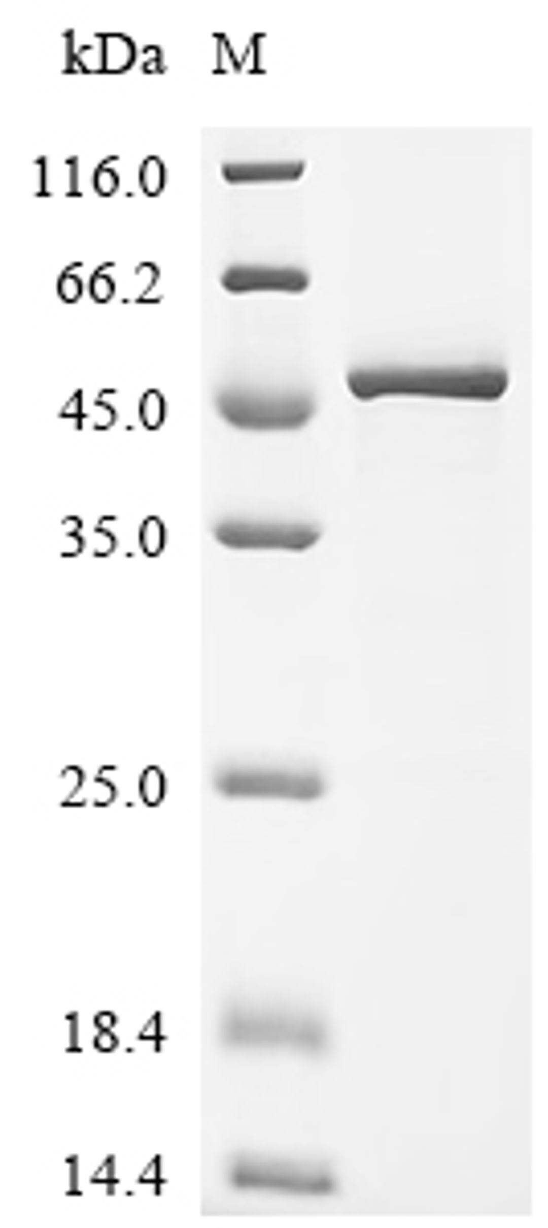 (Tris-Glycine gel) Discontinuous SDS-PAGE (reduced) with 5% enrichment gel and 15% separation gel.
