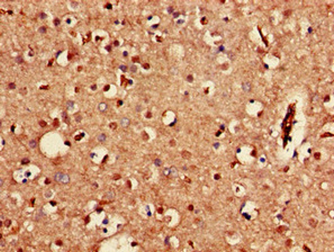 Immunohistochemistry of paraffin-embedded human brain tissue using CSB-PA012056LA01HU at dilution of 1:100