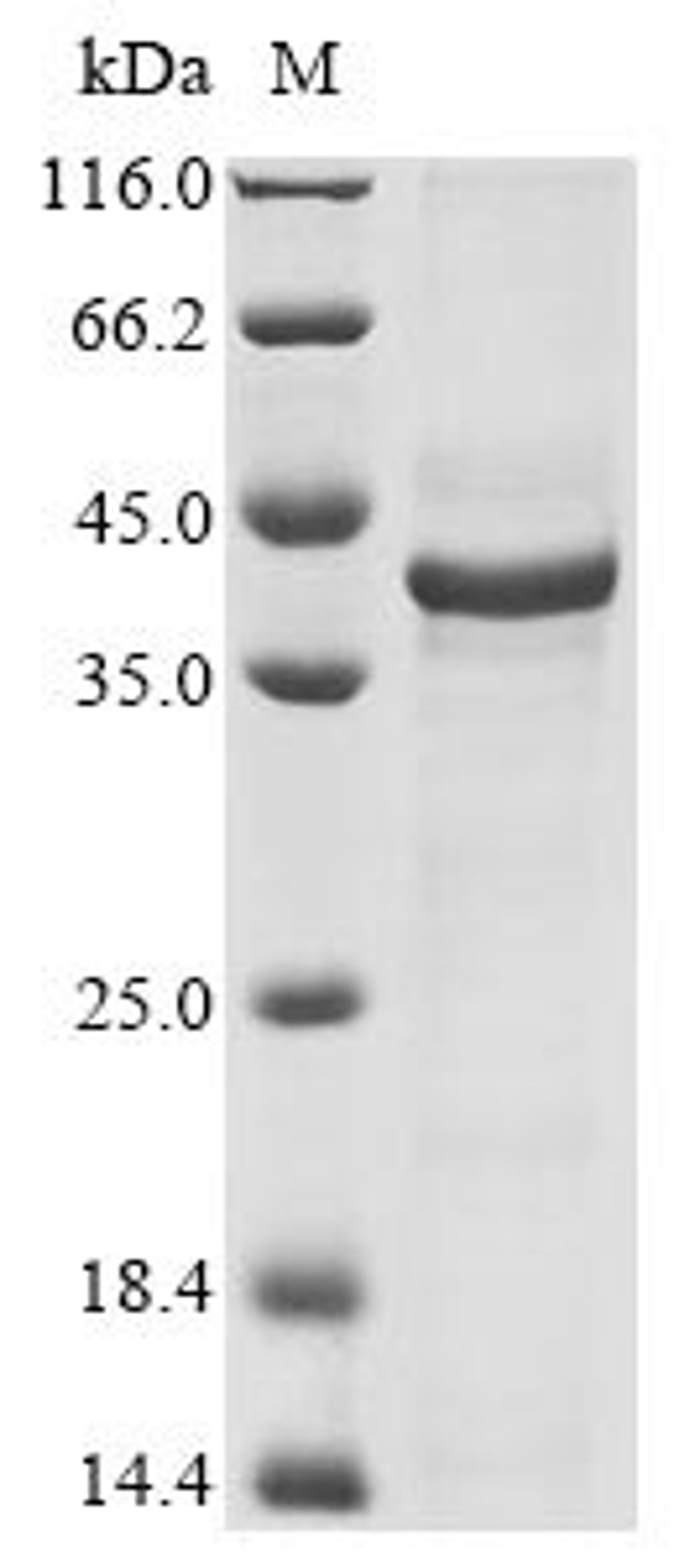 (Tris-Glycine gel) Discontinuous SDS-PAGE (reduced) with 5% enrichment gel and 15% separation gel.
