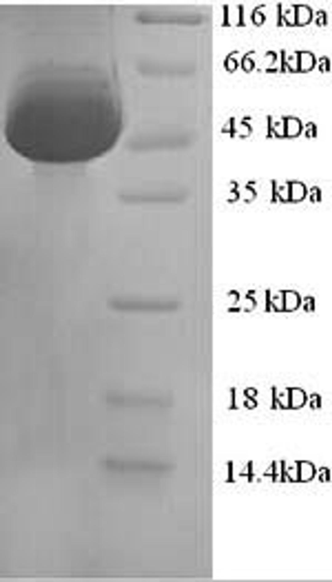 (Tris-Glycine gel) Discontinuous SDS-PAGE (reduced) with 5% enrichment gel and 15% separation gel.