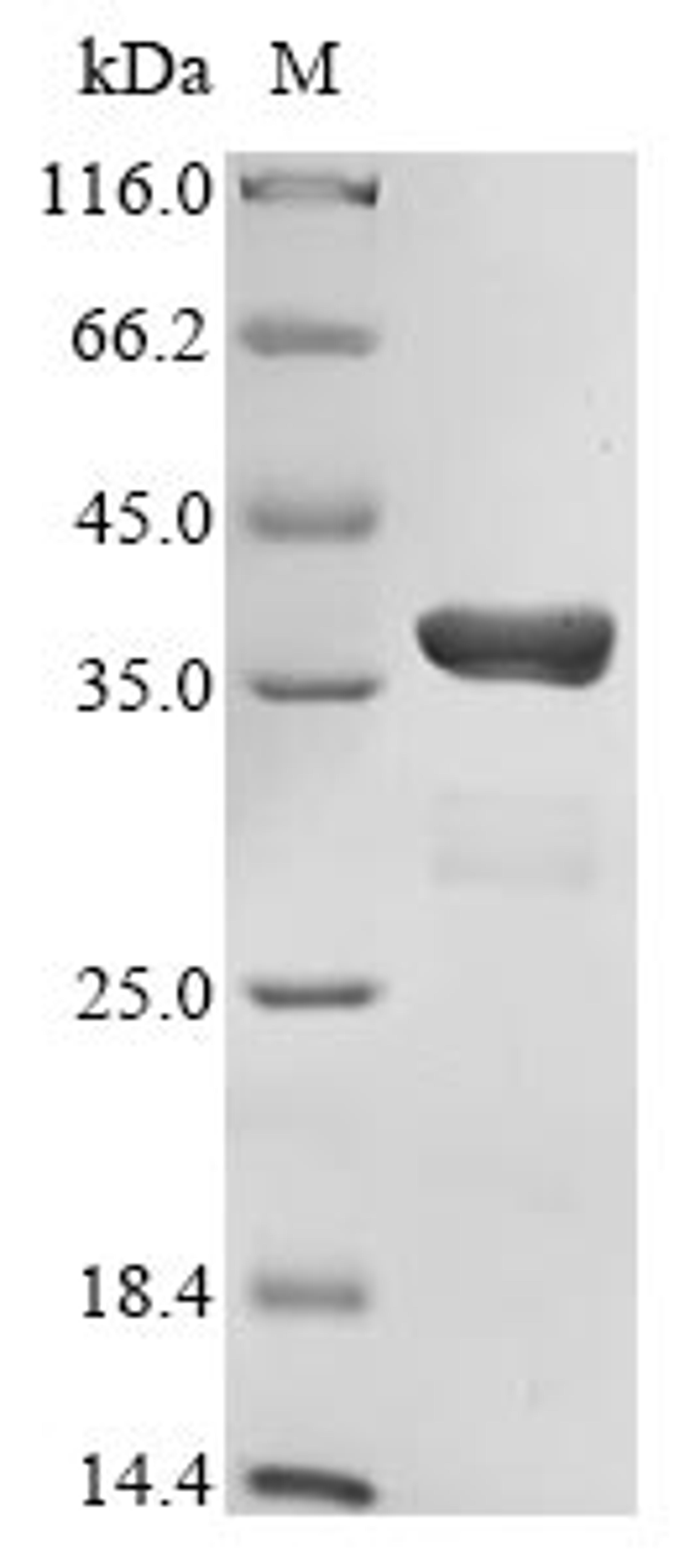 (Tris-Glycine gel) Discontinuous SDS-PAGE (reduced) with 5% enrichment gel and 15% separation gel.